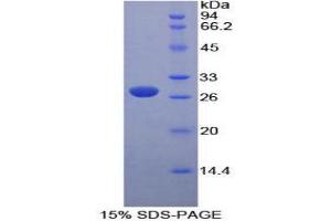 SDS-PAGE analysis of Mouse PK Protein.