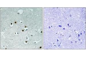 Immunohistochemistry analysis of paraffin-embedded human brain tissue, using HP1 alpha (Ab-92) Antibody. (CBX5 抗体  (AA 58-107))