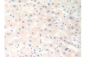 IHC-P analysis of Human Liver Tissue, with DAB staining. (Cathepsin K 抗体  (AA 54-317))