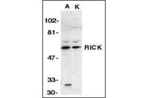 Western blot analysis of RICK in A431 (A) and K562 (K) whole cell lysate with this product at 1:1000 dilution. (RIPK2 抗体  (N-Term))