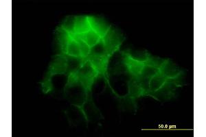 Immunofluorescence of monoclonal antibody to PCDH1 on A-431 cell.