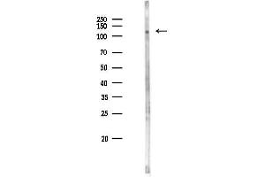 anti-PR Domain Containing 10 (PRDM10) (C-Term) antibody