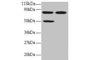 Western blot All lanes: CCL22 antibody at 2 μg/mL Lane 1: 293T whole cell lysate Lane 2: EC109 whole cell lysate Secondary Goat polyclonal to rabbit IgG at 1/15000 dilution Predicted band size: 11 kDa Observed band size: 50, 80 kDa (CCL22 抗体  (AA 25-82))