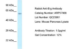 Western Blotting (WB) image for anti-ERG, ETS transcription factor (ERG) (C-Term) antibody (ABIN2787486) (ERG 抗体  (C-Term))