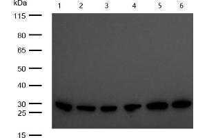All lanes : C1QBP Rabbit mAb at 1/1k dilution Lane 1 : 3T3 whole cell lysates Lane 2 : Mouse Brain lysates Lane 3 : Mouse Kidney lysates Lane 4 : C6 whole cell lysates Lane 5 : Rat Brain lysates Lane 6 : Rat Kidney lysates Lysates/proteins at 20 μg per lane. (Recombinant C1QBP 抗体)