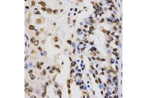 Immunohistochemistry (Paraffin-embedded Sections) (IHC (p)) image for anti-Histone 3 (H3) (H3K9me3) antibody (ABIN3016030)