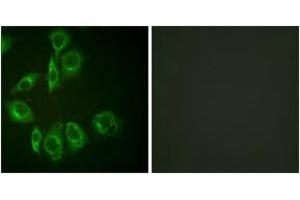 Immunofluorescence analysis of HuvEc cells, using PKC-pan (Ab-Thr497) Antibody. (PKC 抗体  (Thr497))