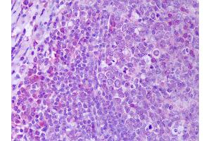 Anti-RANKL antibody IHC of human tonsil, germinal center.