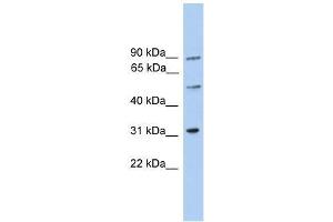 C6orf182 antibody used at 0. (CEP57L1 抗体  (Middle Region))
