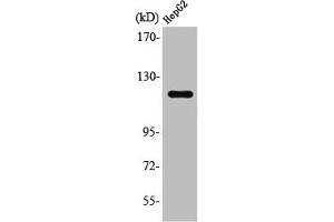 Western Blot analysis of Jurkat cells using SPT16 Polyclonal Antibody (SUPT16H 抗体  (C-Term))