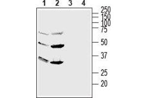 Western blot analysis of human HL-60 promyelocytic leukemia (lanes 1 and 3) and human NK-92 natural killer (lanes 2 and 4) cell line lysates: - 1,2. (GPR56 抗体  (Extracellular, N-Term))