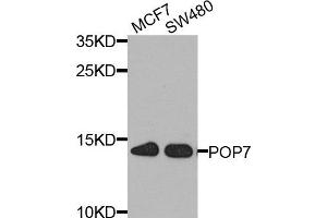 Western blot analysis of extract of MCF7 and SW480 cells, using POP7 antibody. (POP7 抗体)
