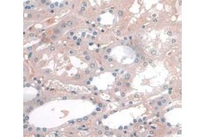 DAB staining on IHC-P; Samples: Human Kidney Tissue. (APOA1 抗体  (AA 122-267))