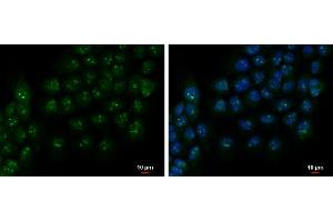 ICC/IF Image PAF49 antibody detects PAF49 protein at nucleolus by immunofluorescent analysis. (CD3EAP 抗体  (Center))