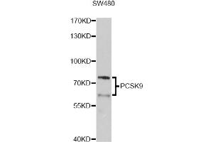 Western blot analysis of extracts of SW480 cells, using PCSK9 Antibody. (PCSK9 抗体)