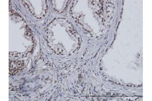 Immunoperoxidase of monoclonal antibody to ESPL1 on formalin-fixed paraffin-embedded human prostate. (Separase 抗体  (AA 586-701))