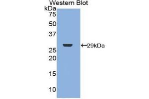 Western blot analysis of the recombinant protein. (Merlin 抗体  (AA 30-239))