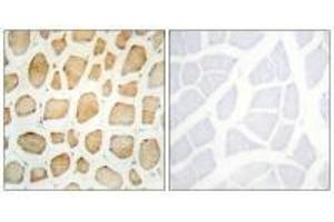 Immunohistochemistry analysis of paraffin-embedded human skeletal muscle tissue using Actin α-2/3 antibody. (ACTN3 抗体  (N-Term))