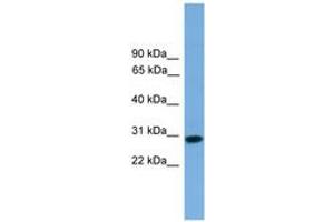 Image no. 1 for anti-Regulator of Calcineurin 2 (RCAN2) (AA 71-120) antibody (ABIN6746341) (RCAN2 抗体  (AA 71-120))