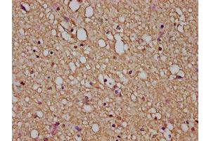 IHC image of ABIN7153853 diluted at 1:200 and staining in paraffin-embedded human brain tissue performed on a Leica BondTM system. (GFAP 抗体  (AA 292-432))