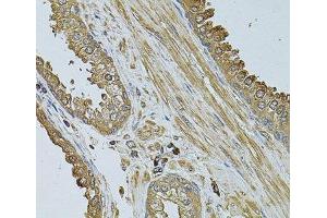 Immunohistochemistry of paraffin-embedded Human prostate using MYLIP Polyclonal Antibody at dilution of 1:100 (40x lens). (MYLIP 抗体)