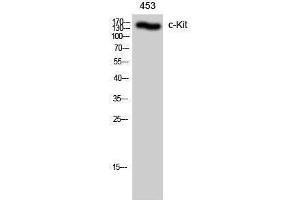 Western Blotting (WB) image for anti-Mast/stem Cell Growth Factor Receptor (KIT) (Ser71) antibody (ABIN3183926) (KIT 抗体  (Ser71))