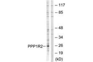 Western blot analysis of extracts from Jurkat cells, using PPP1R2 (Ab-120/121) Antibody. (PPP1R2 抗体  (AA 86-135))