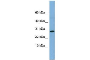 WB Suggested Anti-RPE Antibody Titration: 0. (RPE 抗体  (Middle Region))