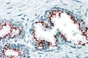 Immunohistochemistry (IHC) image for anti-Golgi Membrane Protein 1 (GOLM1) (C-Term) antibody (ABIN184847)