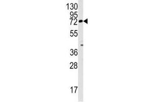 Western blot analysis of Rex1 antibody and mouse lung tissue lysate (ZFP42 抗体  (AA 1-30))