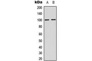Western blot analysis of NF-kappaB p100 (pS865) expression in HeLa (A), MCF7 (B) whole cell lysates. (NFKB2 抗体  (C-Term, pSer865))