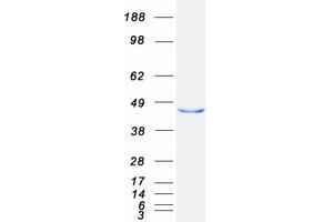 Medium-Chain Specific Acyl-CoA Dehydrogenase, Mitochondrial (MCAD) (Transcript Variant 1) protein (Myc-DYKDDDDK Tag)
