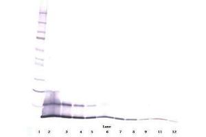 Image no. 1 for anti-Chemokine (C-C Motif) Ligand 5 (CCL5) antibody (ABIN465753) (CCL5 抗体)