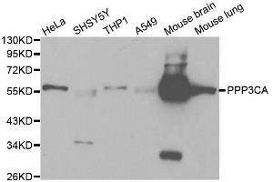 Western blot analysis of extracts of various cell lines, using PPP3CA antibody.