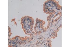 Used in DAB staining on fromalin fixed paraffin- embedded prostate gland tissue (NUP37 抗体  (AA 34-279))