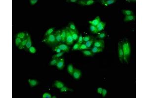 Immunofluorescence staining of HepG2 cells with ABIN7172059 at 1:100, counter-stained with DAPI. (THO Complex 5 抗体  (AA 2-53))