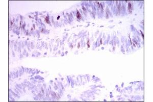 Image no. 1 for anti-Inner Centromere Protein Antigens 135/155kDa (INCENP) antibody (ABIN1491465) (INCENP 抗体)