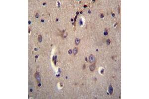 Formalin fixed and paraffin embedded human brain tissue stained with DTNA / DRP3 Antibody (C-term) followed by peroxidase conjugation of the secondary antibody and DAB staining. (DTNA 抗体  (C-Term))