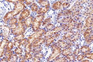 Immunohistochemistry analysis of paraffin-embedded mouse kidney using,DAK (ABIN7073737) at dilution of 1: 5000 (DAK 抗体)