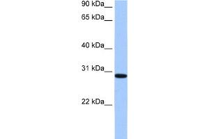 WB Suggested Anti-RALYL Antibody Titration:  0. (RALYL 抗体  (C-Term))