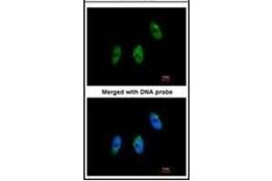 Immunofluorescence analysis of paraformaldehyde-fixed HeLa, using ELP3 antibody at 1/100 dilution. (ELP3/KAT9 抗体)