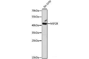 Western blot analysis of extracts of SH-SY5Y cells using MEF2B Polyclonal Antibody at dilution of 1:1000. (MEF2B 抗体)