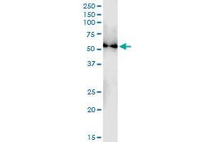 Immunoprecipitation of TUBB4Q transfected lysate using anti-TUBB4Q MaxPab rabbit polyclonal antibody and Protein A Magnetic Bead , and immunoblotted with TUBB4Q MaxPab mouse polyclonal antibody (B01) . (TUBB7P 抗体  (AA 1-434))