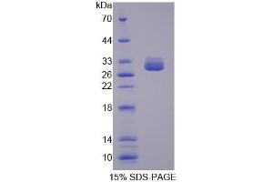 SDS-PAGE analysis of Human MUT Protein.