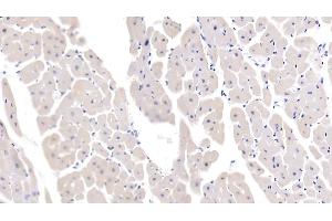 Detection of IL13 in Porcine Cardiac Muscle Tissue using Polyclonal Antibody to Interleukin 13 (IL13) (IL-13 抗体  (AA 25-131))