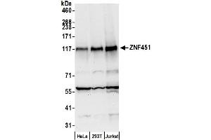 anti-Zinc Finger Protein 451 (ZNF451) (AA 1011-1061) antibody