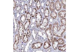 Immunohistochemical staining (Formalin-fixed paraffin-embedded sections) of human kidney with NUDT7 polyclonal antibody  shows strong cytoplasmic positivity in granular pattern in tubular cells. (NUDT7 抗体)