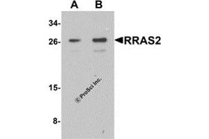 Western Blotting (WB) image for anti-Related RAS Viral (R-Ras) Oncogene Homolog 2 (RRAS2) (C-Term) antibody (ABIN1077448) (RRAS2 抗体  (C-Term))
