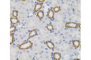 Immunohistochemistry of paraffin-embedded Mouse kidney using SIGMAR1 Polyclonal Antibody (SIGMAR1 抗体)