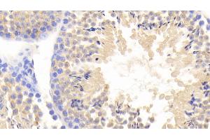 Detection of FBLN1 in Mouse Testis Tissue using Polyclonal Antibody to Fibulin 1 (FBLN1) (Fibulin 1 抗体  (AA 399-578))